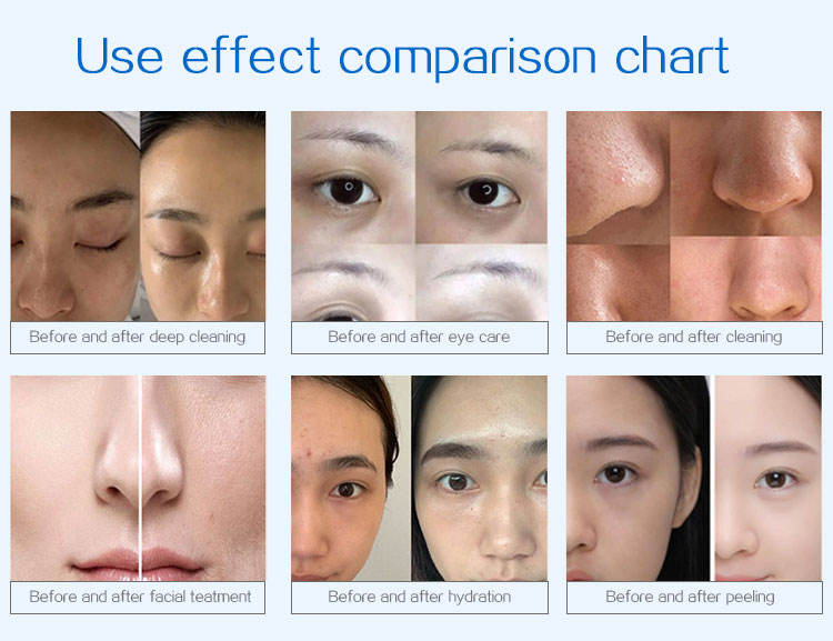 hydra facial machine 9