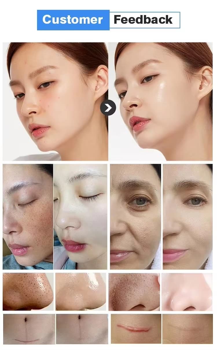 hydra facial machine 11
