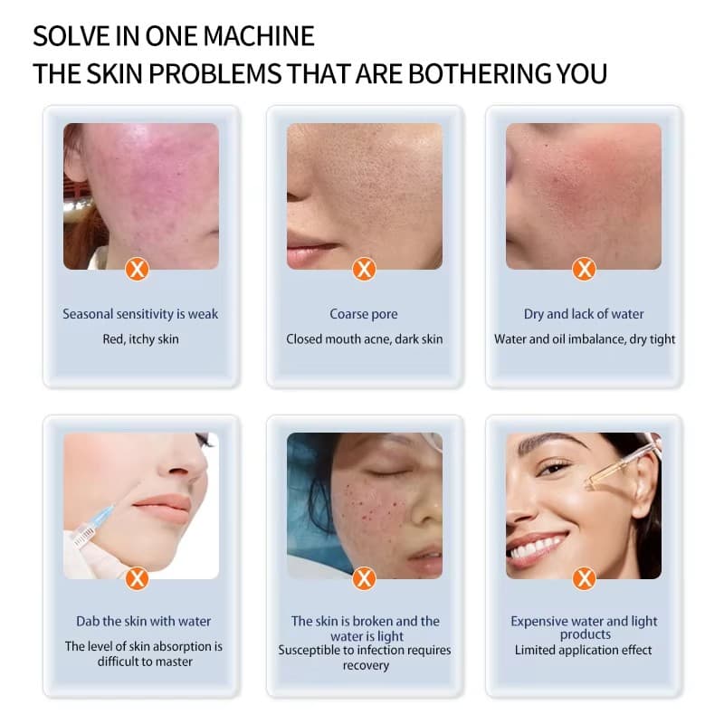 hello face3 mesotherapy device 8