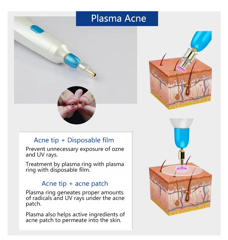 New Technology Plasma Jet Pen 10