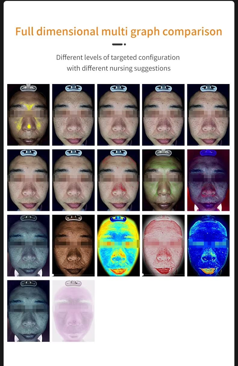 Skin Analyzer 9