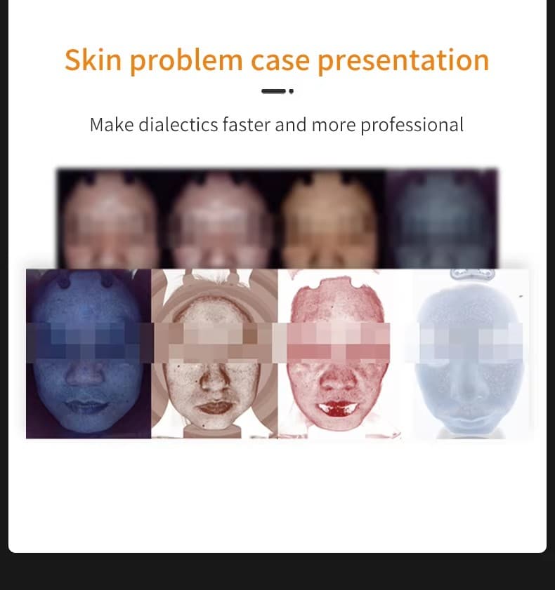 Skin Analyzer 10